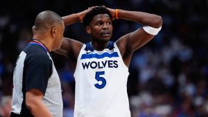 Anthony Edwards sufre un edema óseo